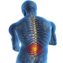 Nové poznatky ohľadne bolesti dolnej časti chrbta - klinická štúdia